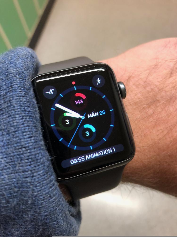 Smartwatch